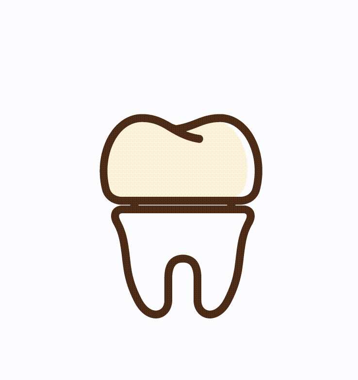 Dental Crowns